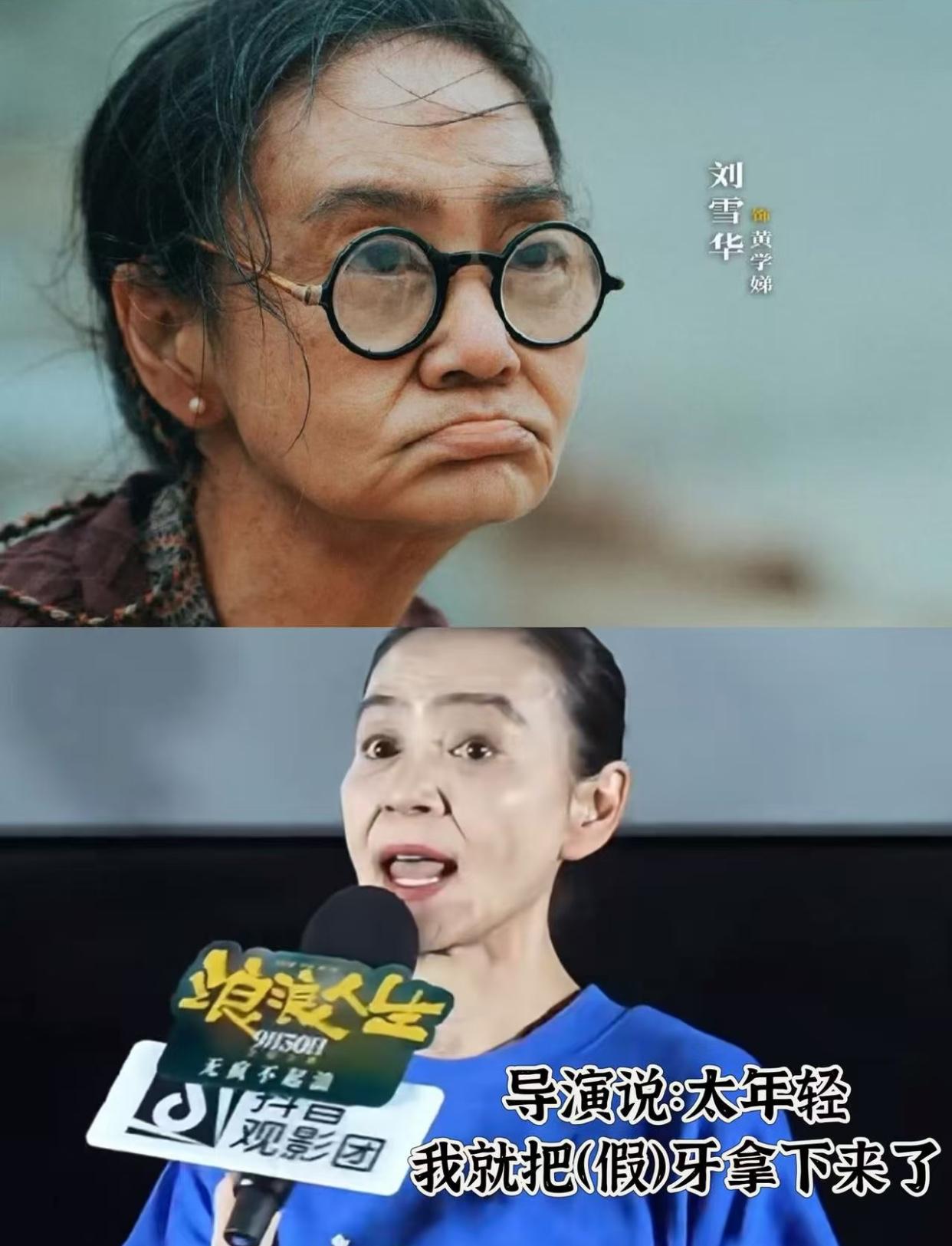 问的也对，
明星那么有钱怎么不种牙呢？
看刘雪华老师说去面试角色时导演嫌她看起来