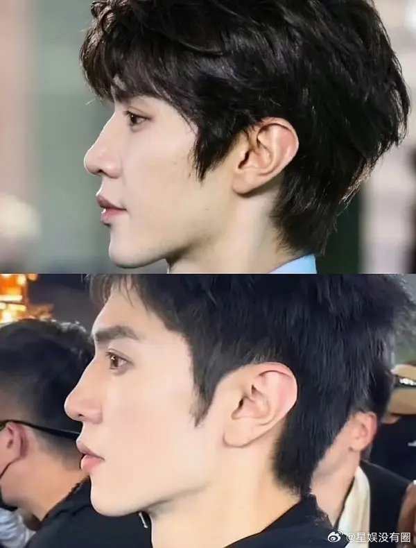 陈哲远哪版微调更合理养眼呢