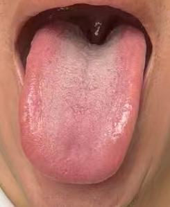 伤精久虚海绵体难起？补肝益肾，活血通阳，助你坚韧振奋





很多人因为伤精过