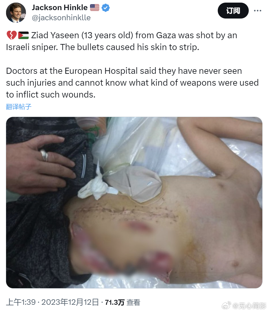 来自加沙的 Ziad Yaseen（13 岁）被以色列狙击手击中。子弹导致他的皮