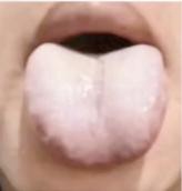 这会儿不忙，继续给大伙儿看舌象啦！不管是男女老少，我都认真对待，绝不糊弄。我本人