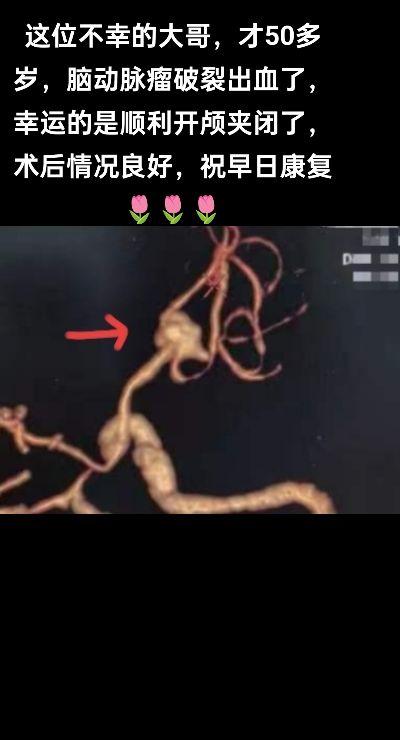 医生日常 医路前行 医者仁心