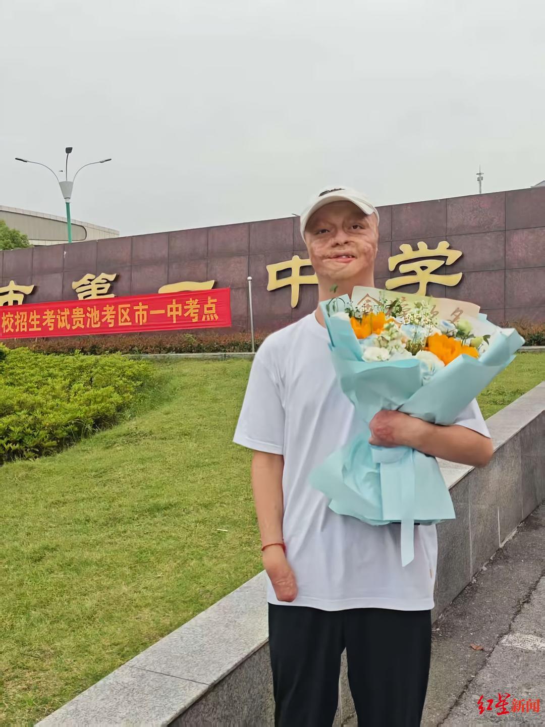 【#安徽烧伤男孩被东南大学录取# 计划未来读研读博】#烧伤男孩未来计划读研读博#