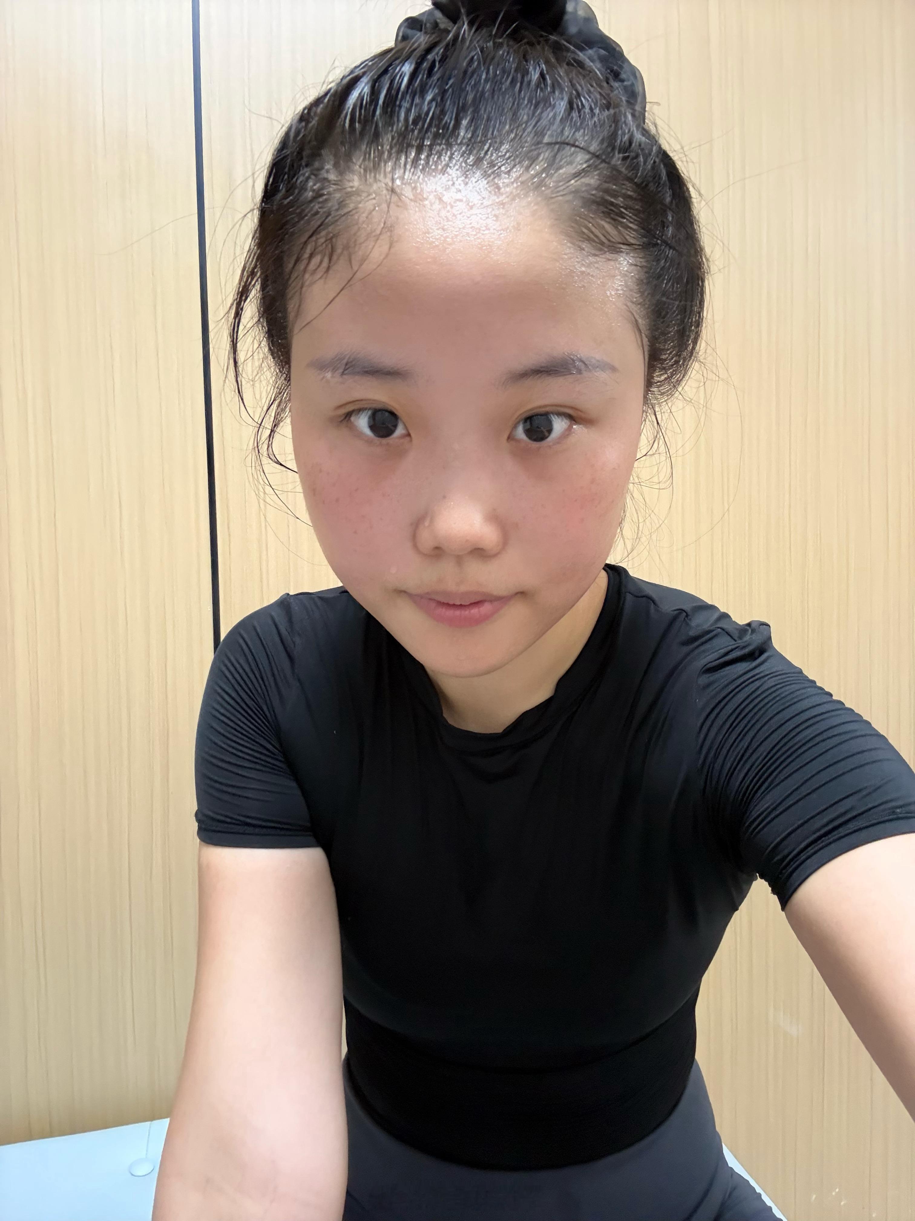 卧槽太逗了。。。我减肥30斤的脸部变化，其实我之前也没感觉自己脸有多胖，一对比好