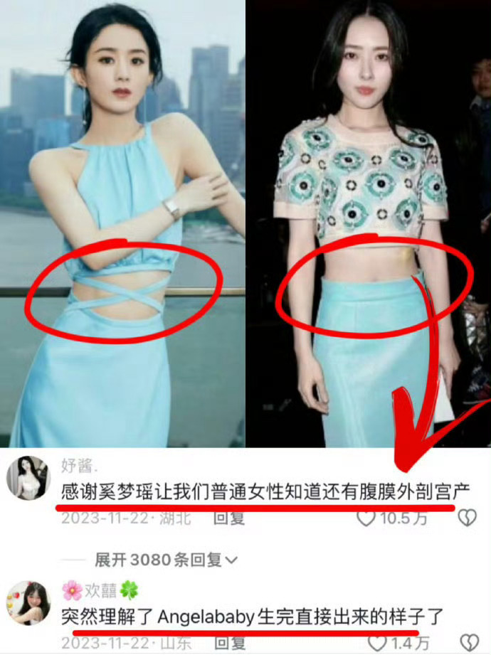 怪不得明星都选择剖 