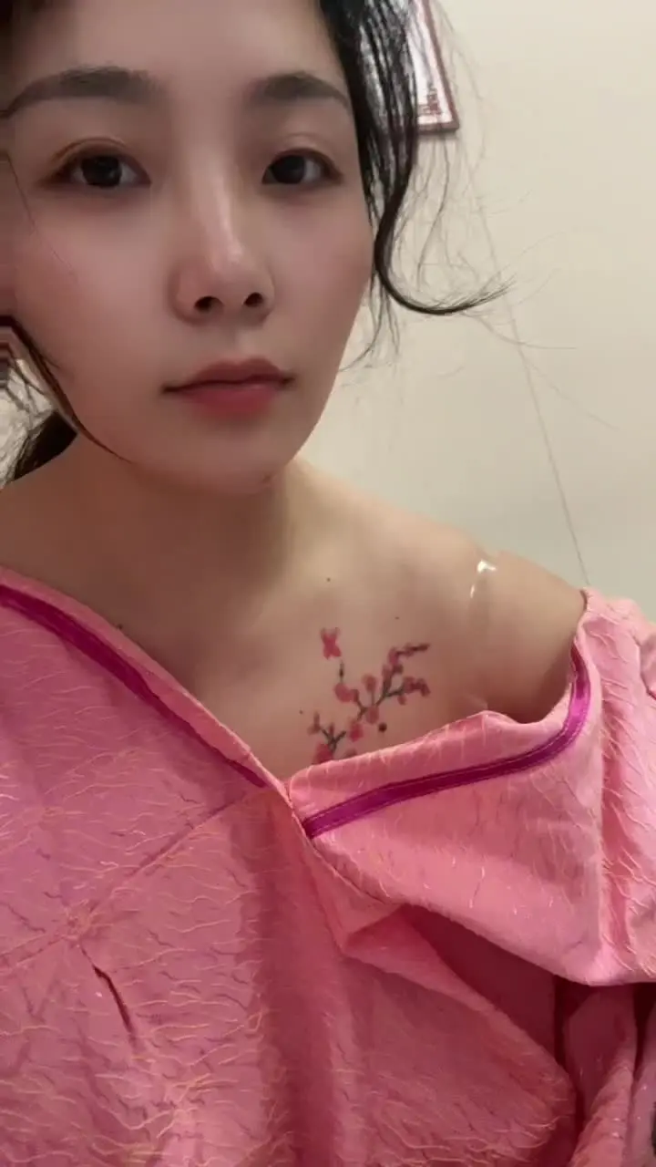 拆线了