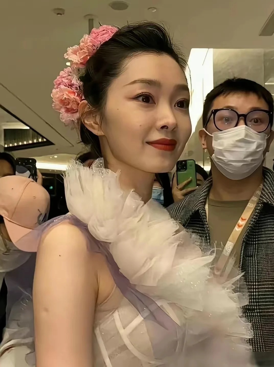 原来明星胳膊上也有这个疤 
