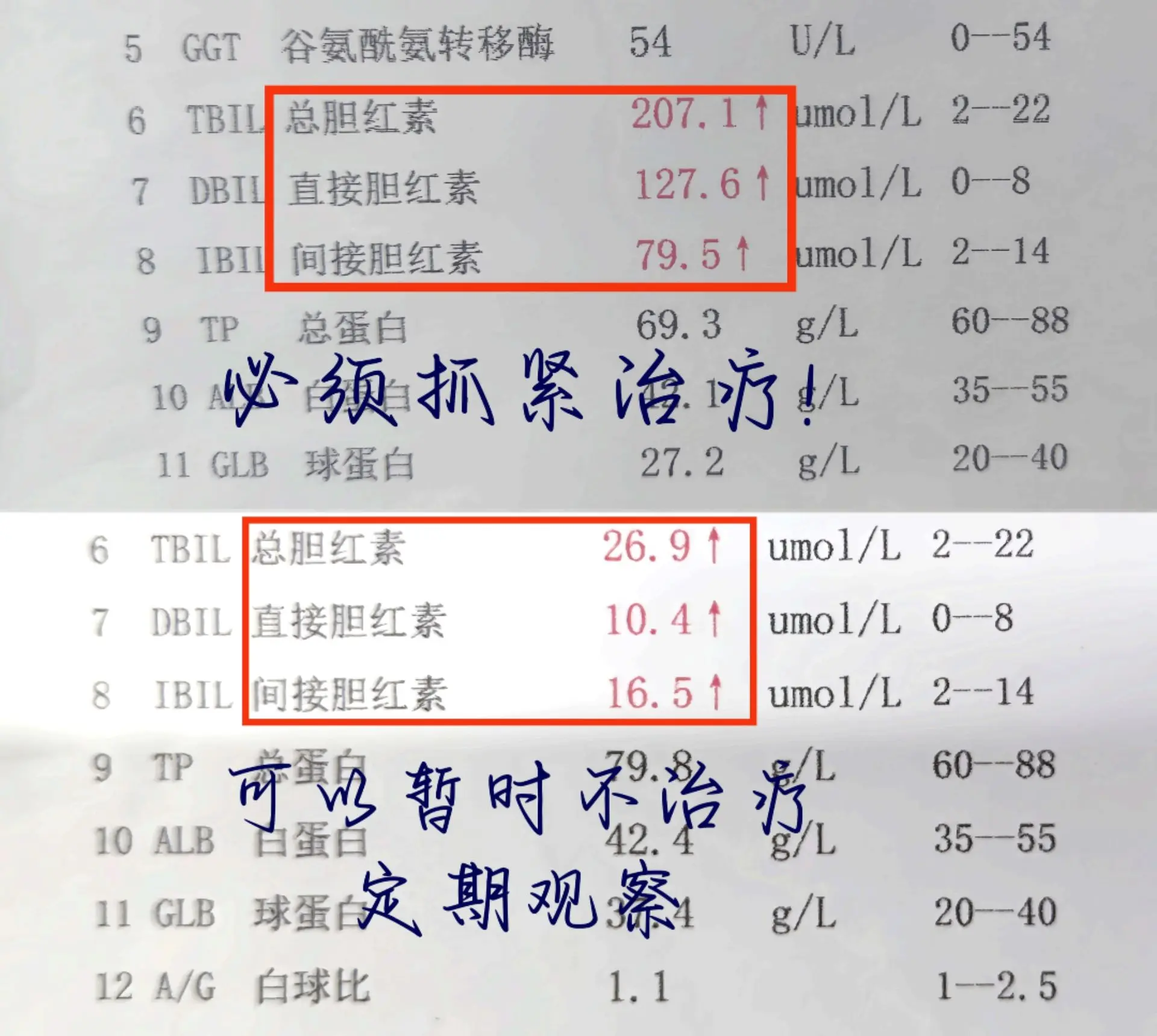 胆红素升高一种必须治！一种不用管！一有些胆红素升高，是生理性原因导致的...