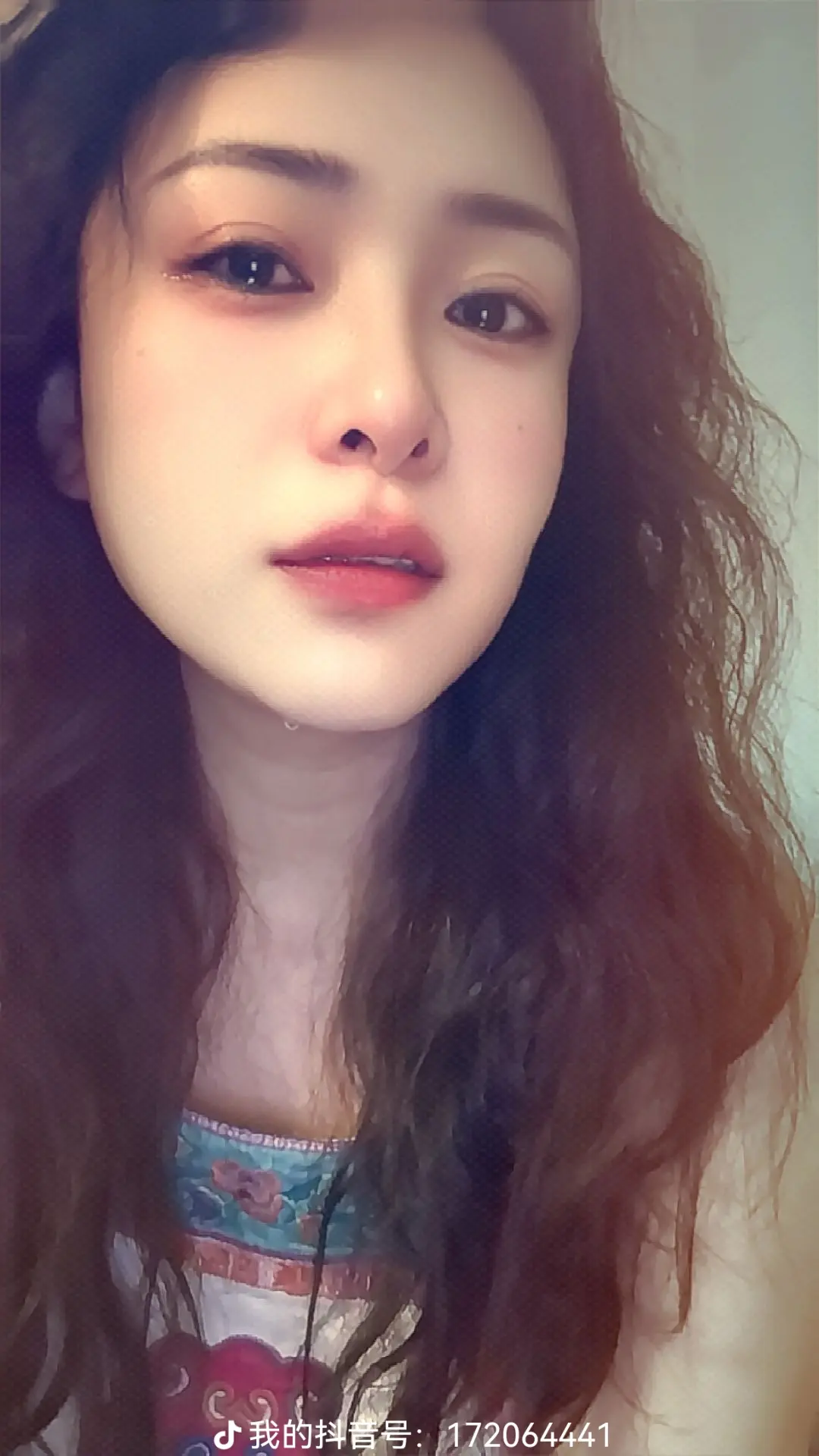 又开始了，最近频繁手脚发麻，惊恐发作，胸口堵的慌，心悸，后背疼，头懵...