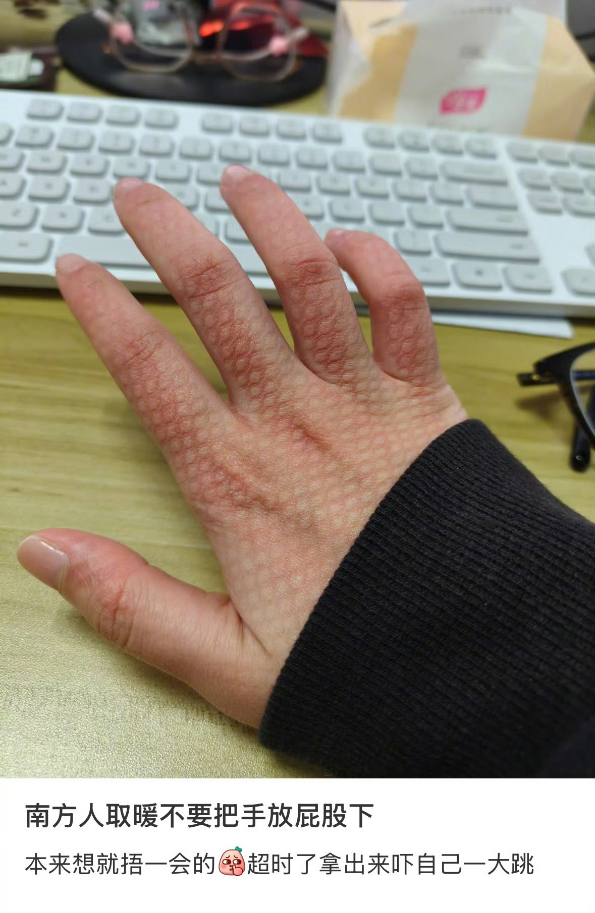 南方人不要把手放屁股下取暖了乍一看热搜，我都不理解是什么动作，看了图片恍然大悟说