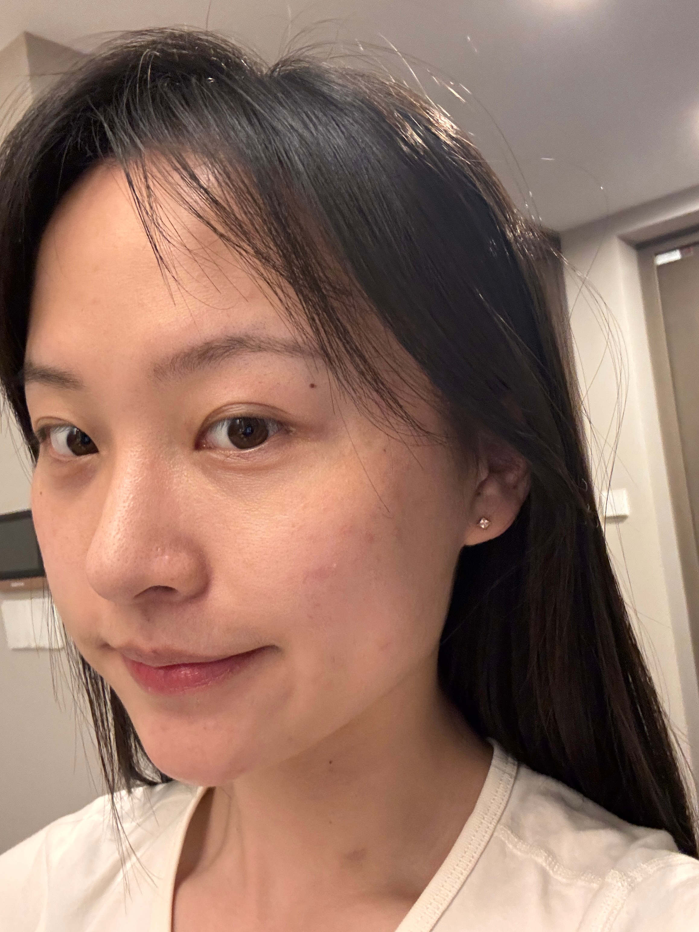 呀 感觉过敏就快要好啦我的日常plog日常