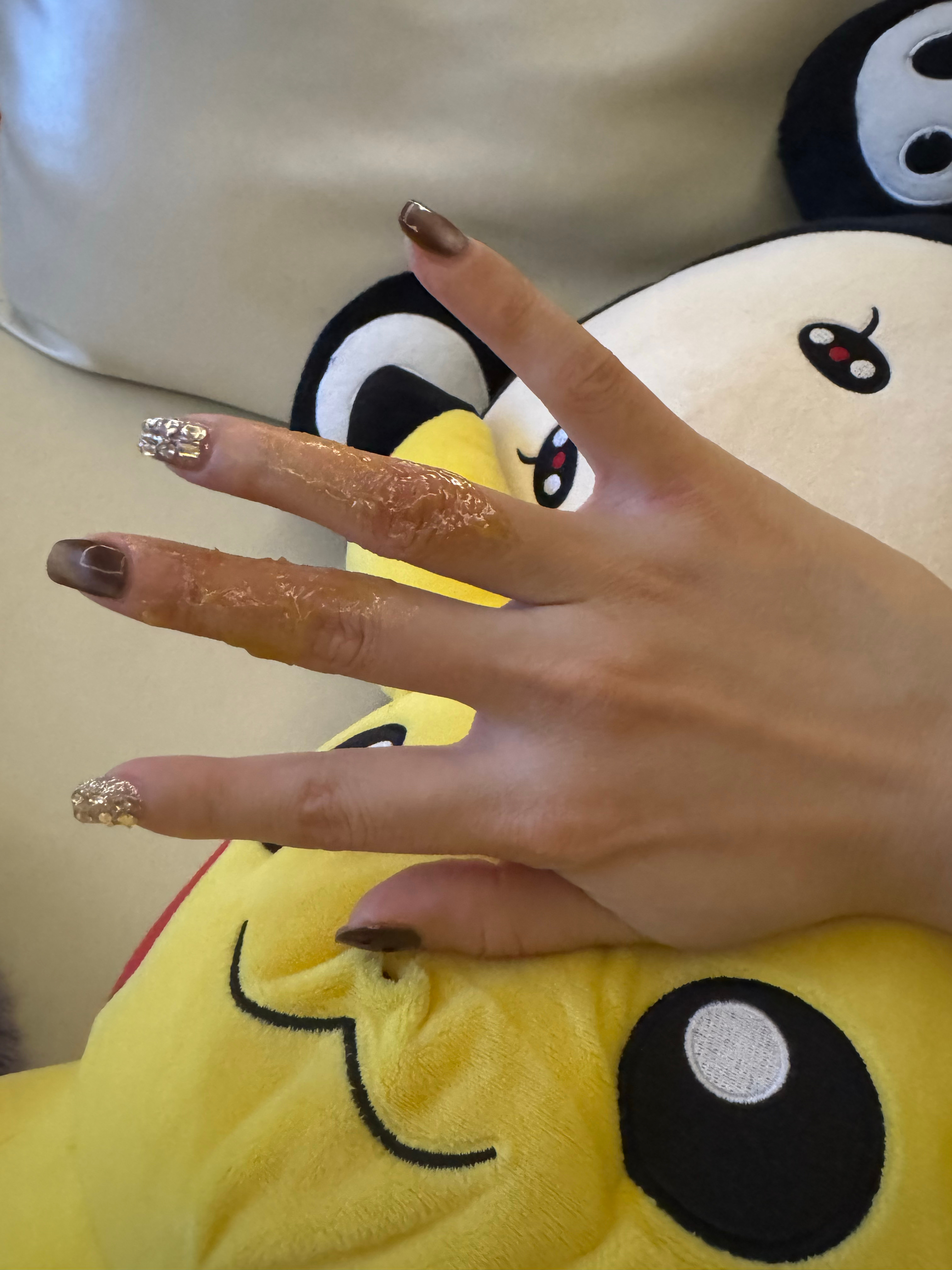 第二次做红烧肉 第一次把灶台炸的都是汁儿 这次把手炸成蹄子了