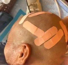 天津大爷再一次令人刮目相看，剃头被“练手”，满头伤口却不较真：善良的样子太暖心