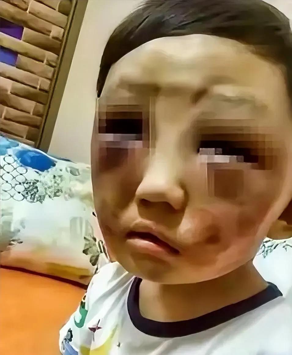 天哪，太恐怖了，谁敢下那么毒的手打小孩，照样给她抽回去！
报警，必须报警！这已经