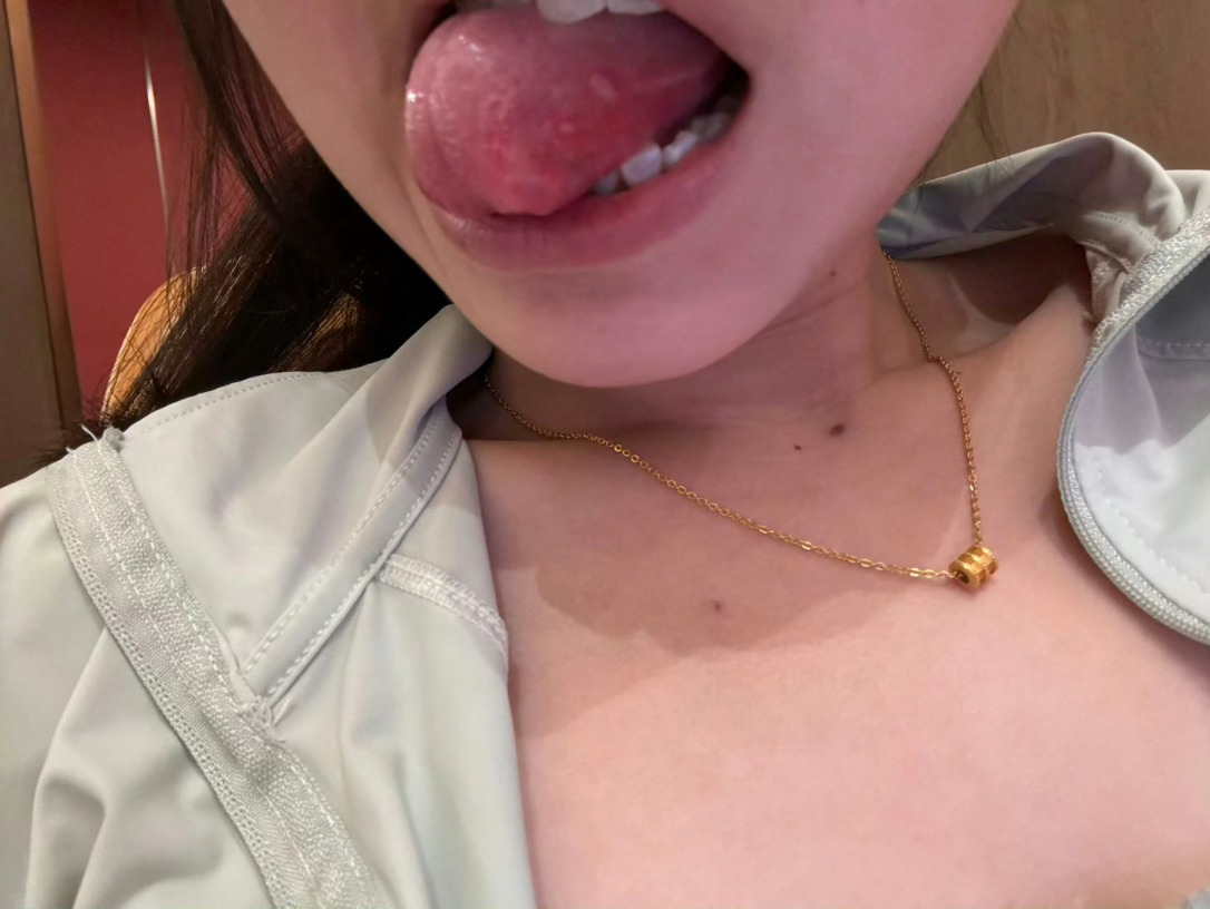 吃多了真的容易上火  广州·广州圣心大教堂