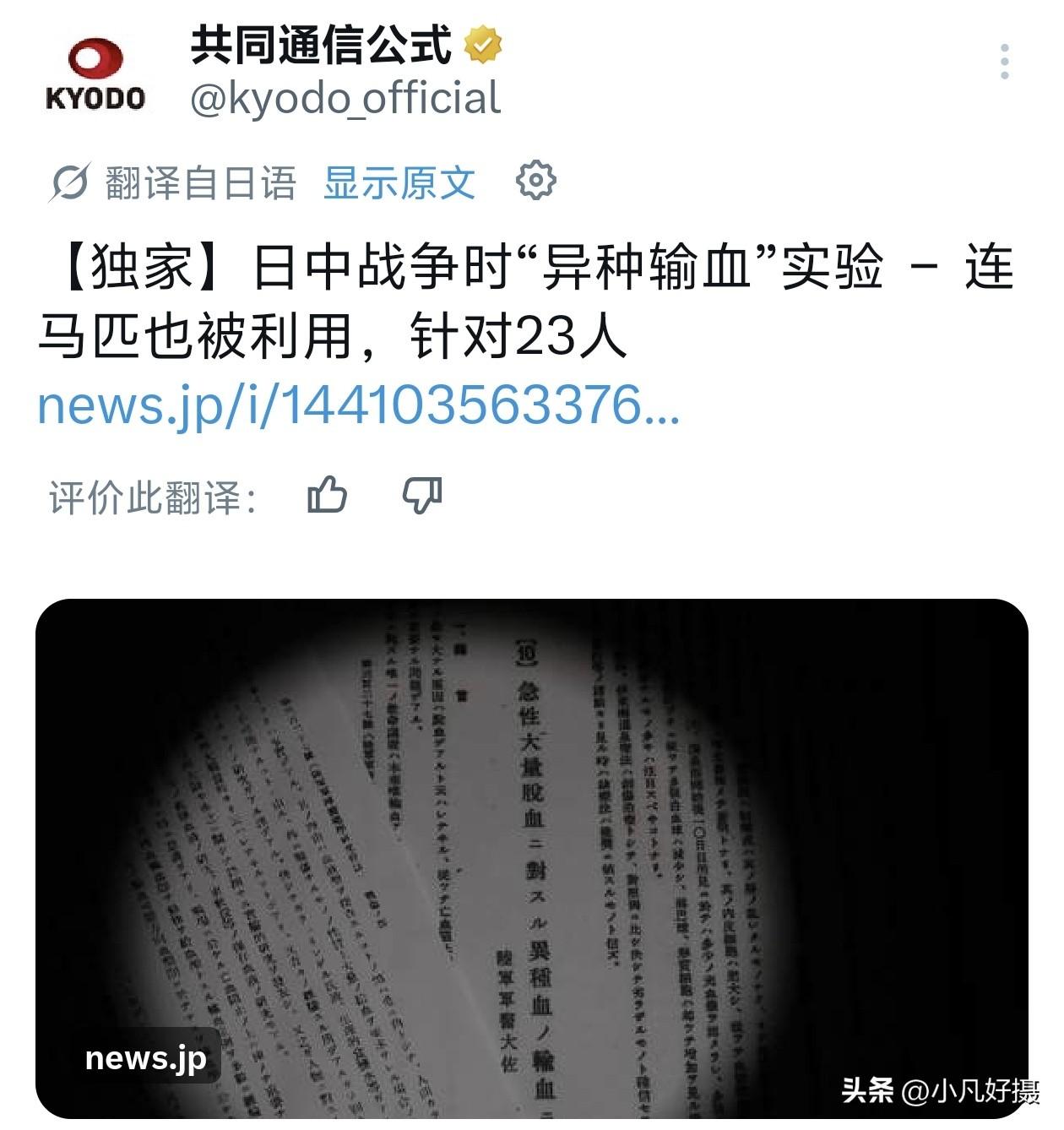 禽兽不如的东西！[发怒]
据日媒：东京军医学校教官曾反复开展向人体注射动物血液的