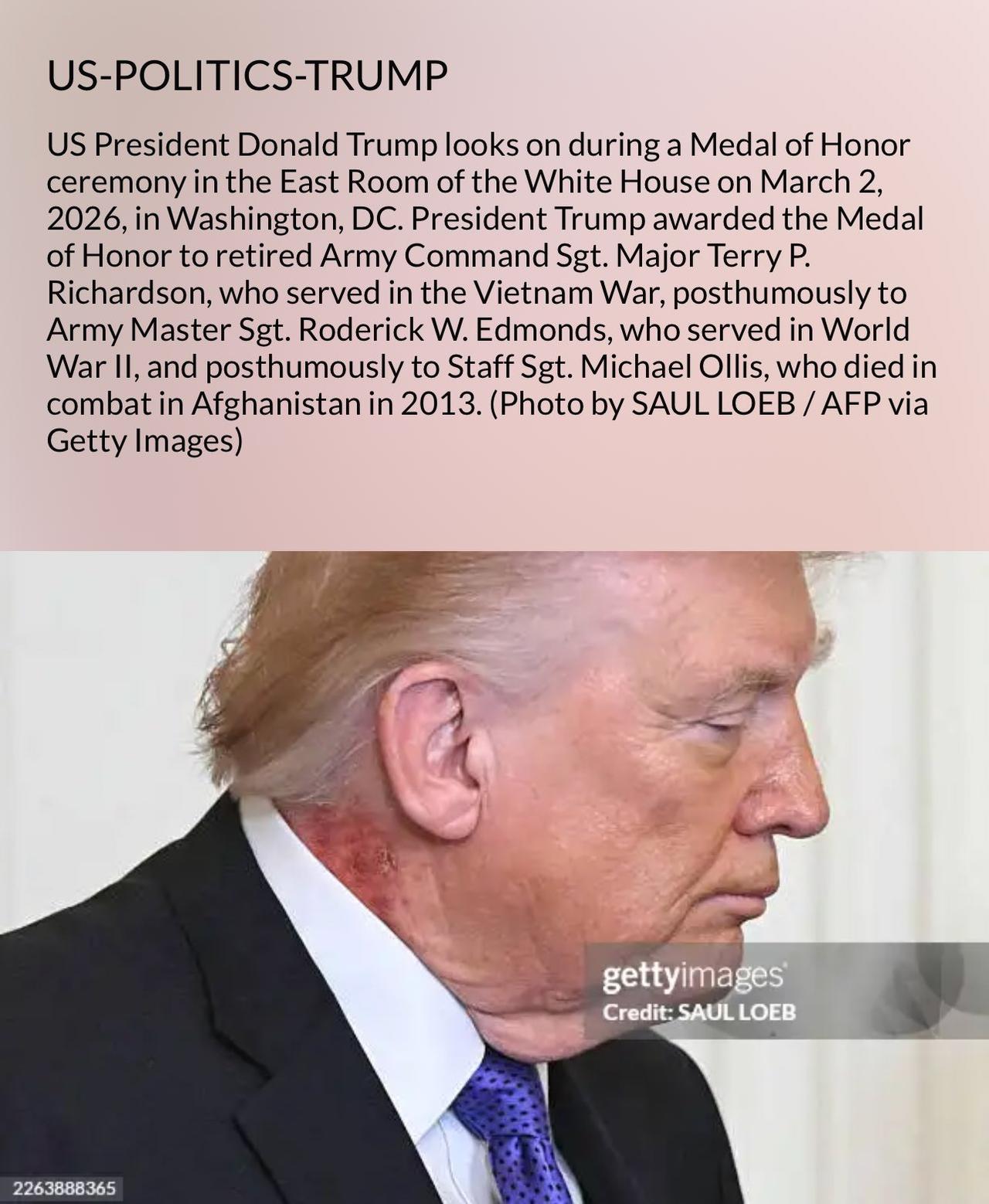 哈梅内伊在召换吗？特朗普被发现颈部有类似红疹的疑似溃烂痕迹，年纪大了脾气又火爆。