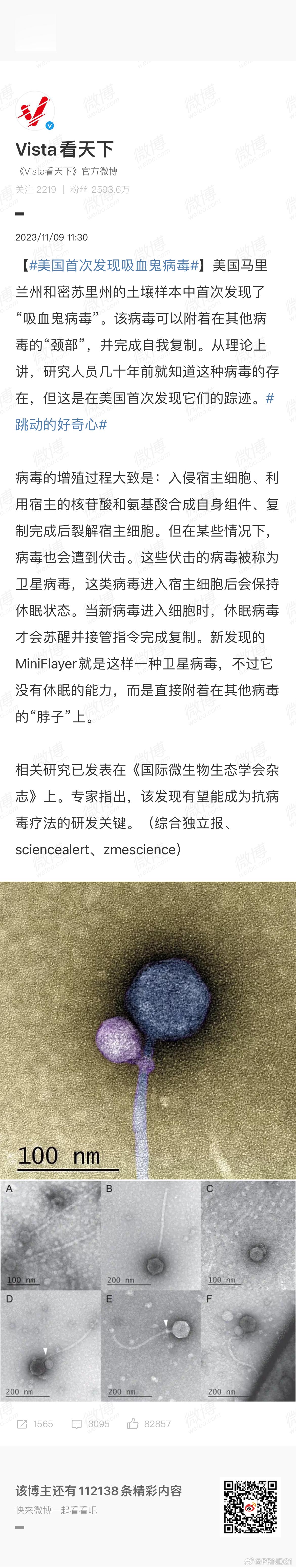 #美国首次发现吸血鬼病毒# 这名字其实有点耸人听闻了，从说明来看，这病毒只是“借