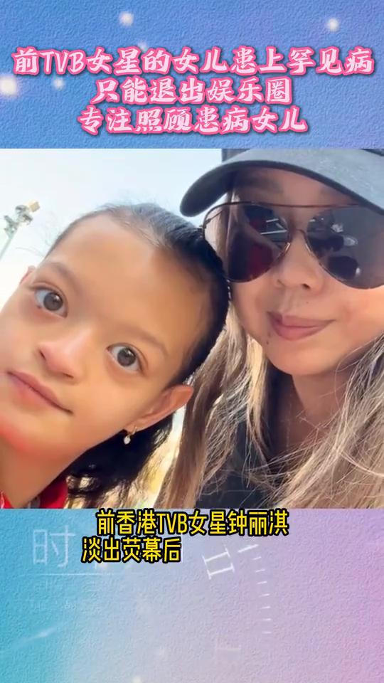 前TVB女星的女儿患上罕见病，只能退出娱乐圈，专注照顾患病女儿。
前香港TVB女