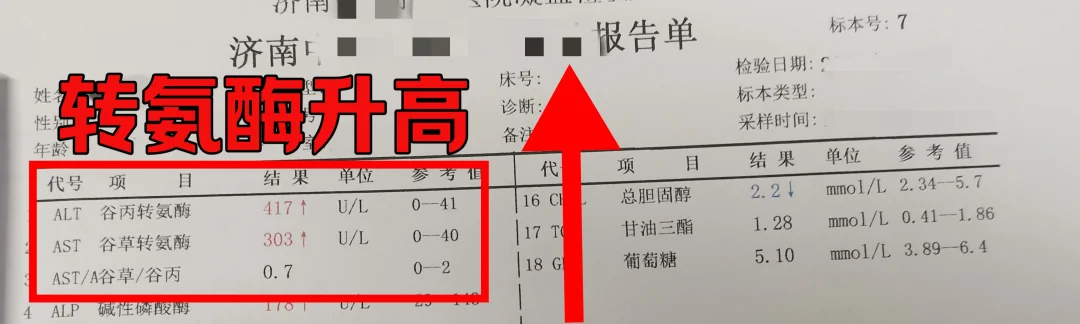 转氨酶升高=肝病加重？真相来了！