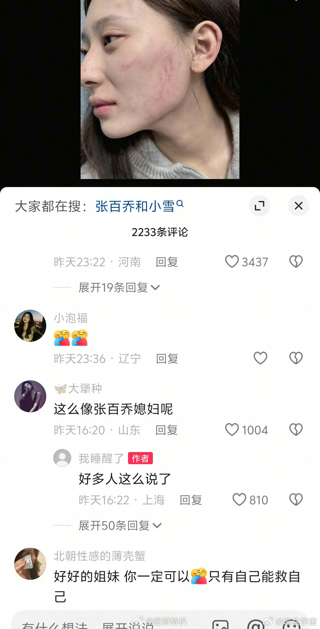 是有点像小雪，但是小雪是原生双眼皮有点内双的，那个美女是做的欧式大双，不一样，但