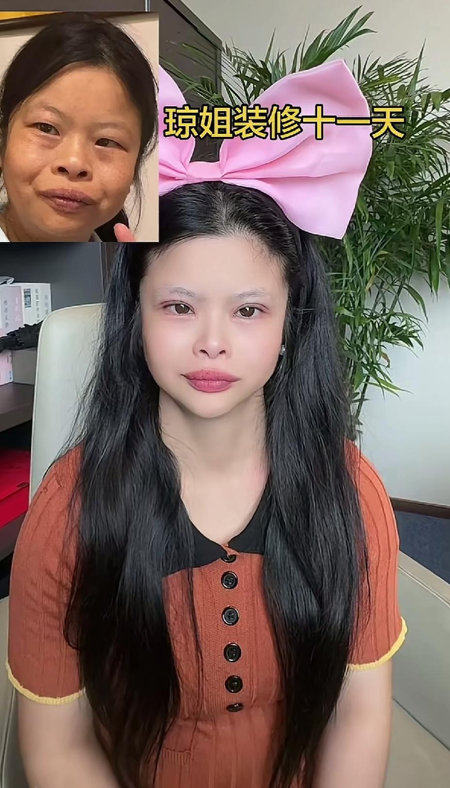 网红琼姐变美了，曾经那个丑小鸭，越来越好看。