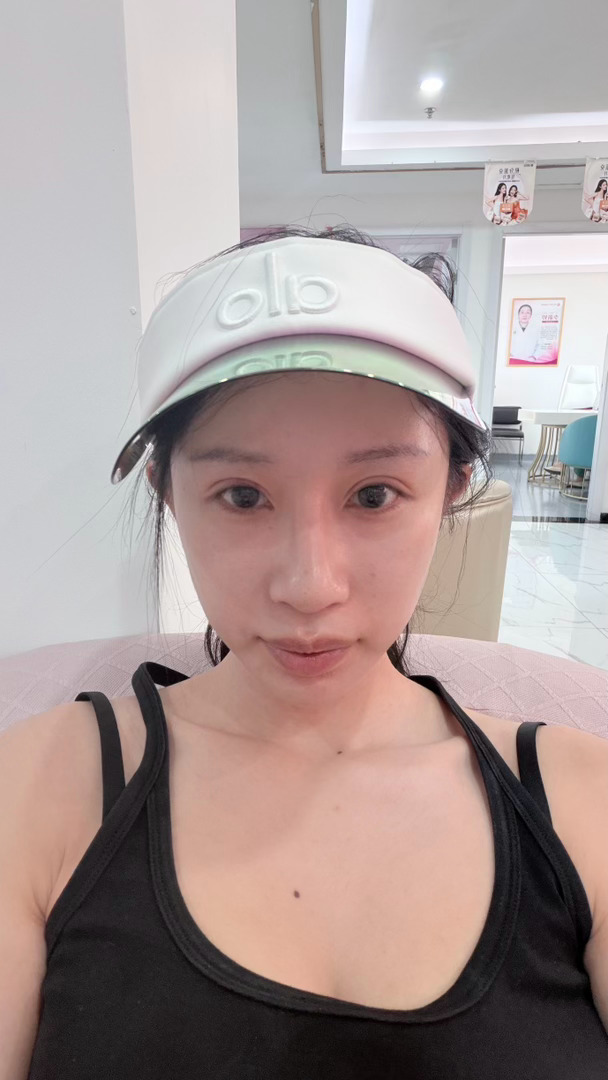 day7 拆完线了 马上就能工作了 