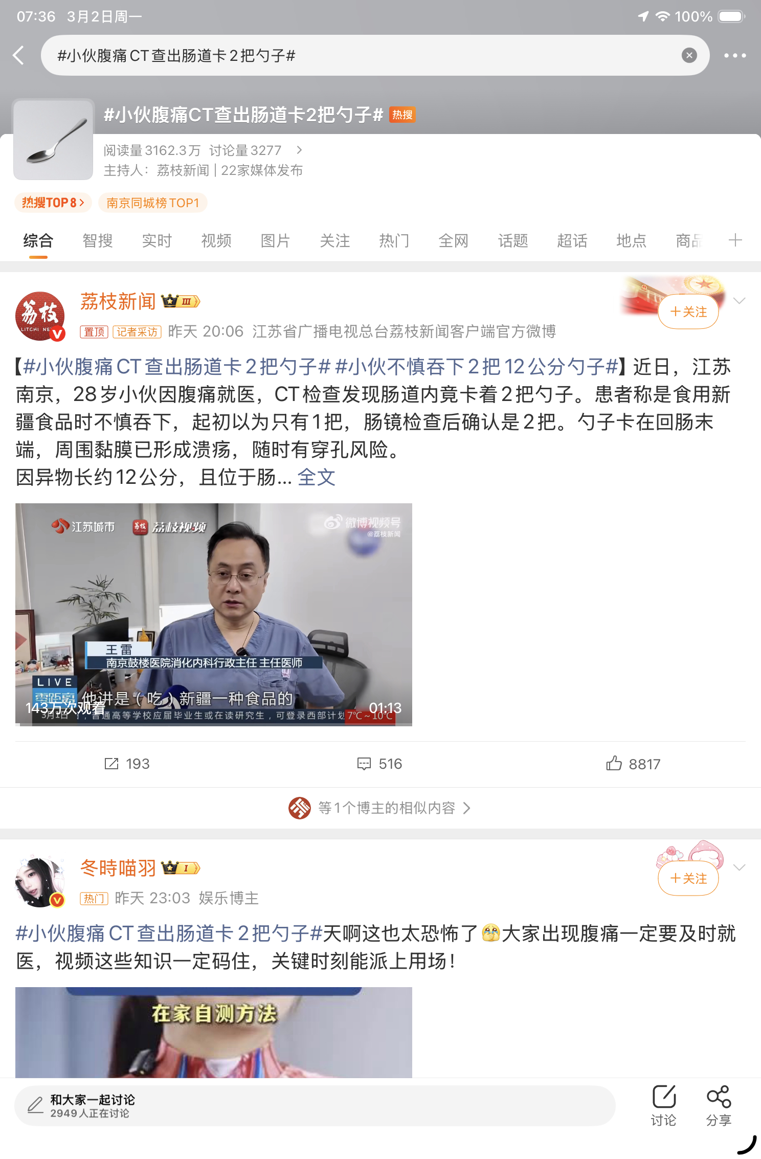 小伙腹痛CT查出肠道卡2把勺子？我怎么就不信呢……12公分的勺子啊……两把。。不