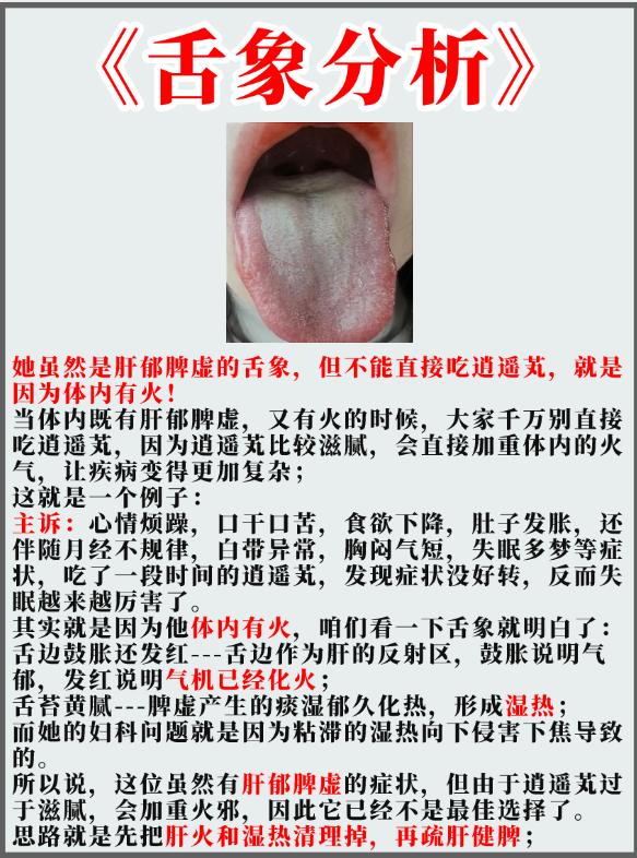 她虽然是肝郁脾虚的舌象，但不能直接吃逍遥丸，就是因为体内有火！