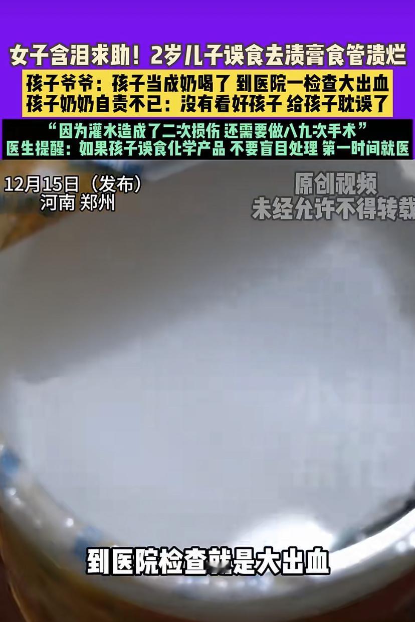 近日，郑州一名2岁男童误将清洁去污膏当成酸奶喝下，导致口腔与食道被严重腐蚀。情急