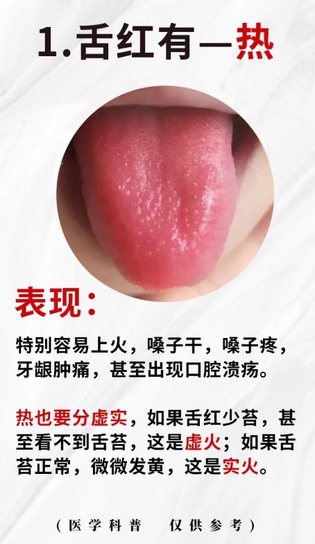 4 种舌象信号，看懂身体寒热虚实