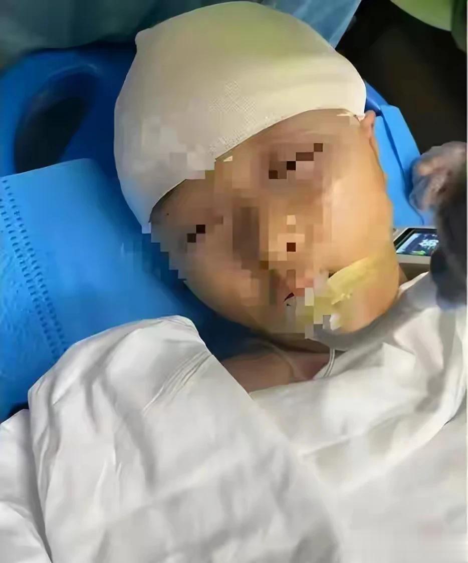 同班同学家长透露：后脑一个大洞，脑浆都出来了！很明显贯穿伤。
“我家小孩就读的学