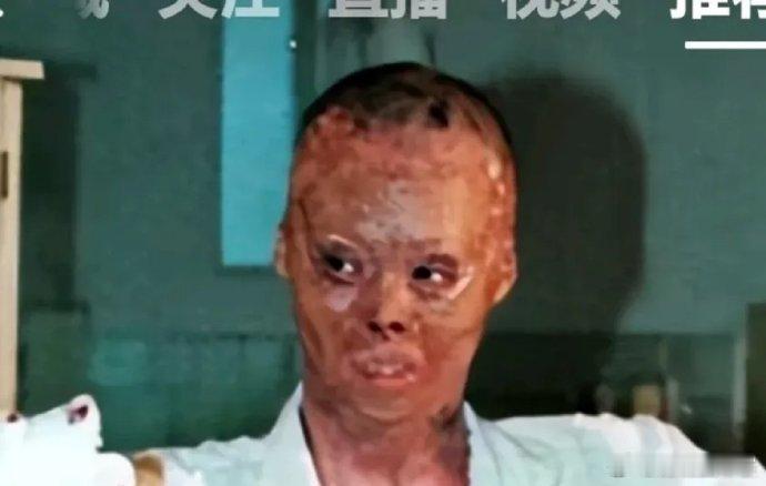 救了一车27人，自己被烧的面目全非，致敬救火英雄梁强！！ ​ ​​​