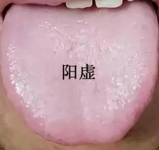 身上这几个地方鼓起来，多是阳气不足的表现！

 
1、肚子鼓——脾胃虚寒
伴随：