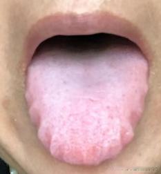 气血虚、虚则寒、寒则湿！中医教你1招，大补气血，恢复胃动力
这位粉丝，最近一段时