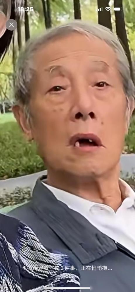 上海一个80多岁的老父亲说：他唯一的女儿在18岁的时候，突然之间患上了系统性红斑