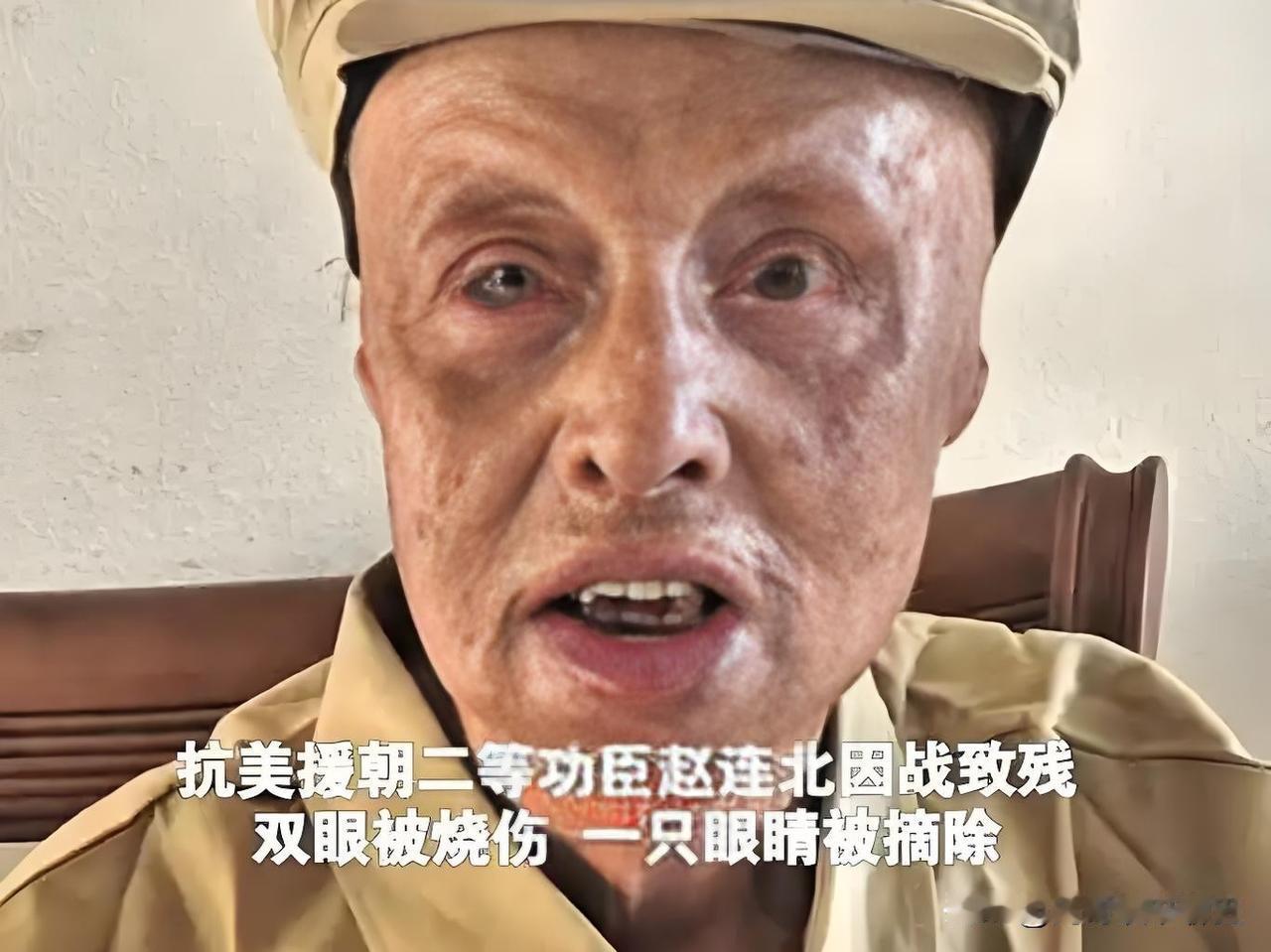 颤抖的手摸向空洞的左眼窝，93岁的赵连北只重复一句话：“那时候，顾不上疼啊。”