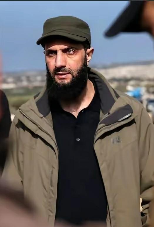 总有人夸朱拉尼长得帅，有啥帅的？他的五官没有一样漂亮的，而且驼峰鼻子和招风耳相当