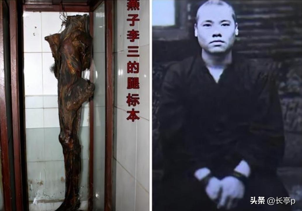 “燕子李三”的真实容貌
旁边就是制成的腿标本
他活跃在上世纪40年代，原名李圣武
