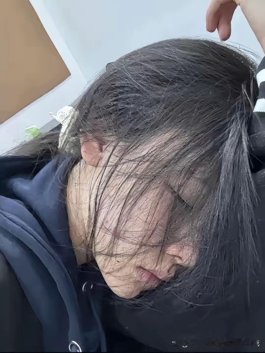 38岁的我，满身病痛，活得像个50岁的废人。直到今天女儿再次扒住阳台栏杆，用死威