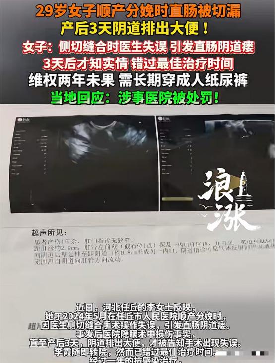 “太坑人了”河北任丘，29岁女子在某医院顺产生娃，3天后，突然在阴道里排出大便，