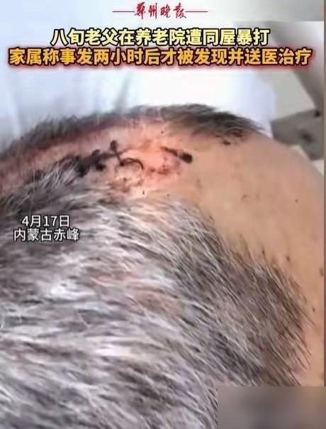 “必须严惩！”内蒙古赤峰，女子将父亲送到养老院，几天后去接，只见父亲裤子直接裂开