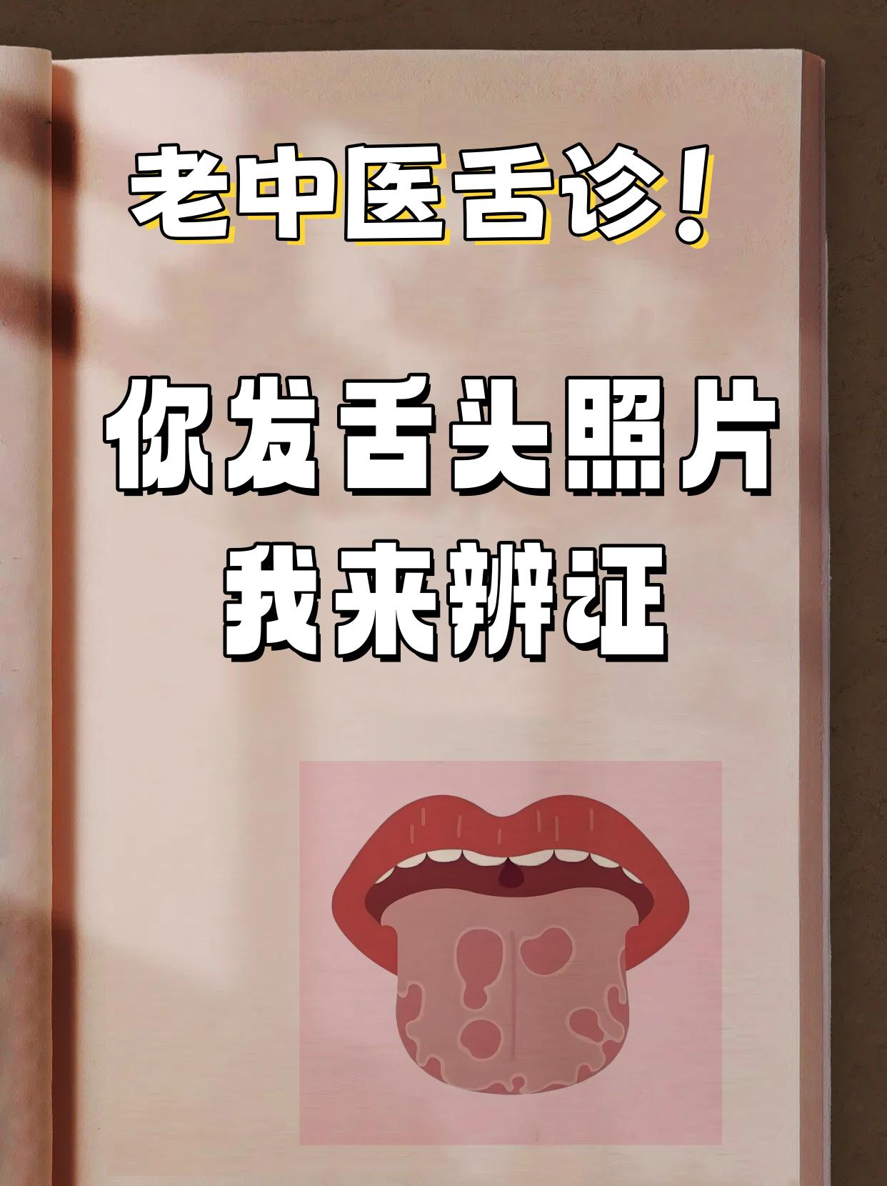 今日舌诊挑战——看完100个舌象！

应粉丝要求，今天继续帮大家看舌象

把舌头