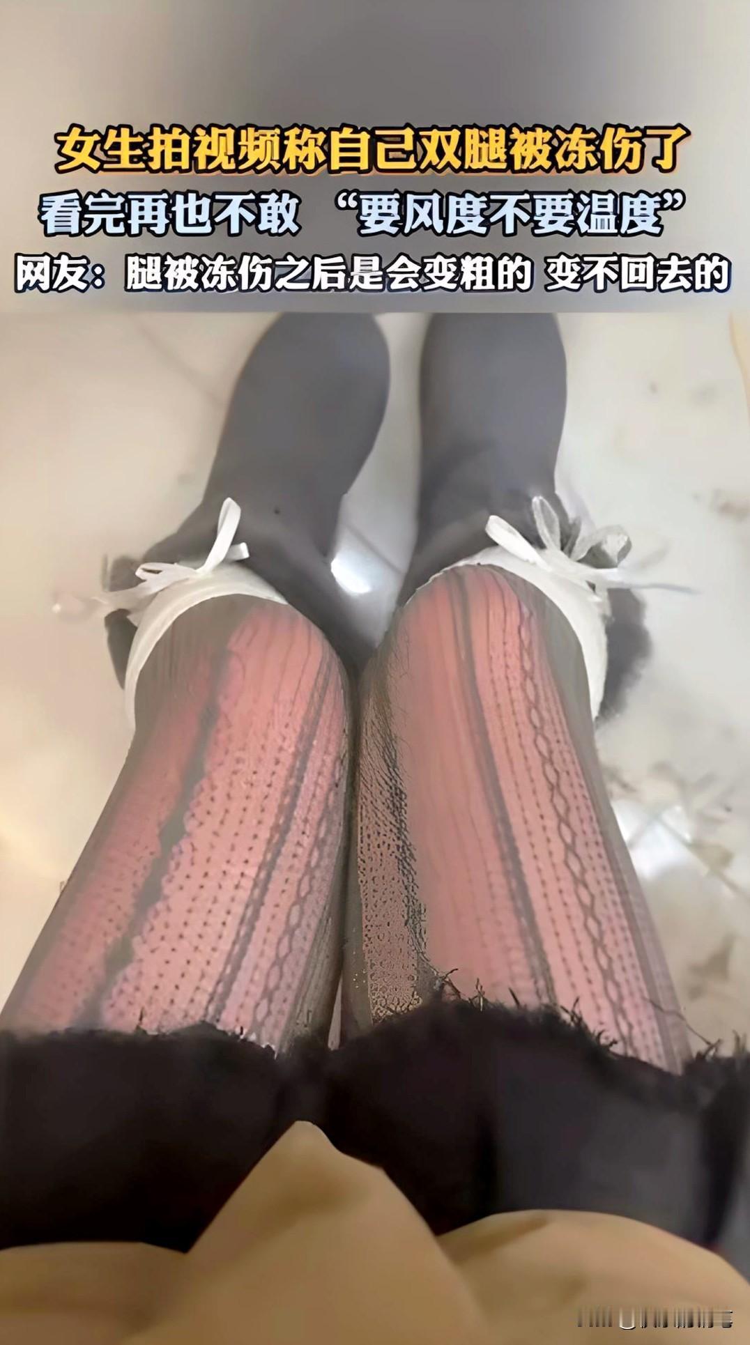 南方女子威海海边穿丝袜拍照，大腿冻得通红！
 
山东威海冬季海边气温低至-5℃，