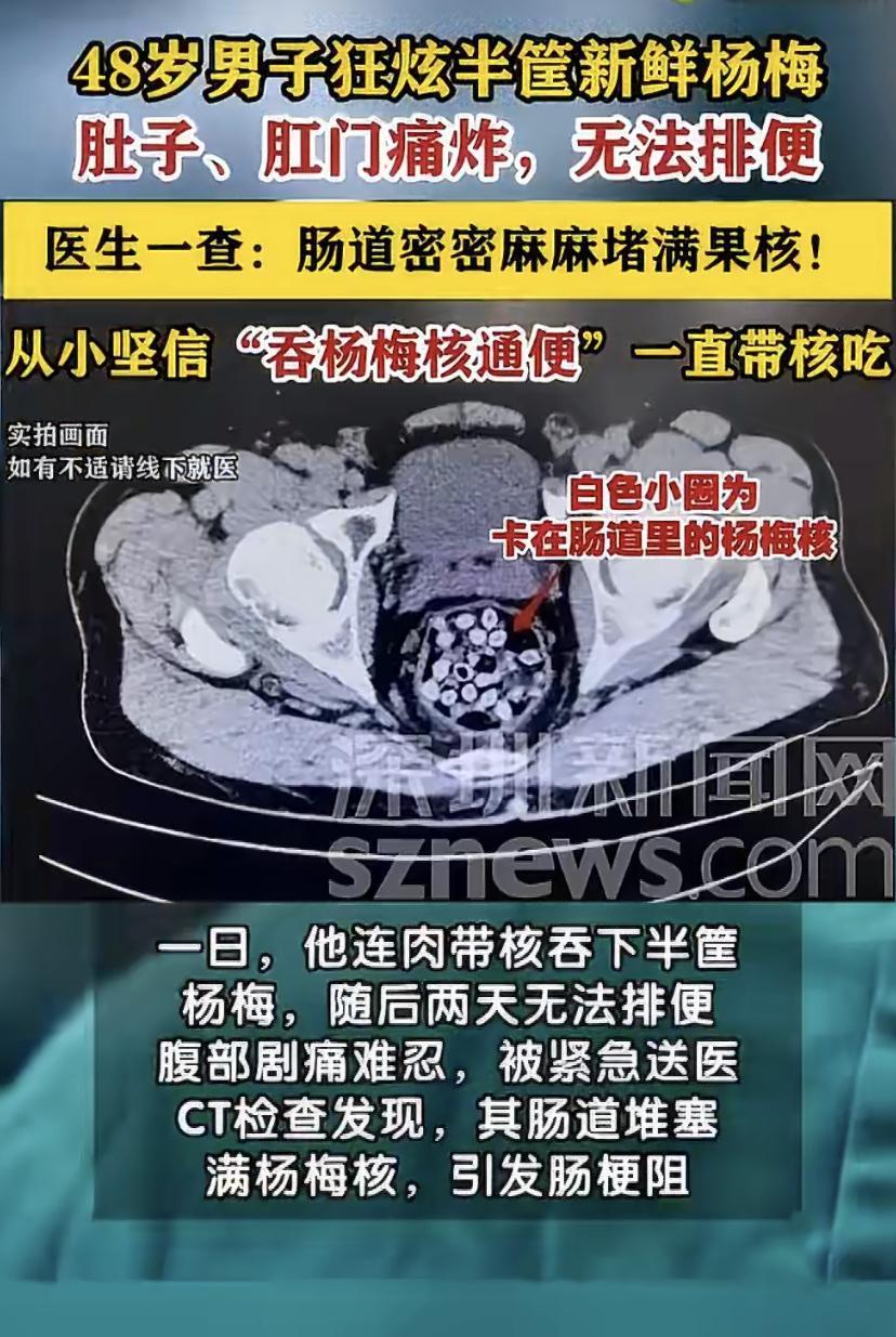 浙江一位48岁的老兄，差点被自己“作”进手术室。
这位黄先生从小就信"杨梅核能清