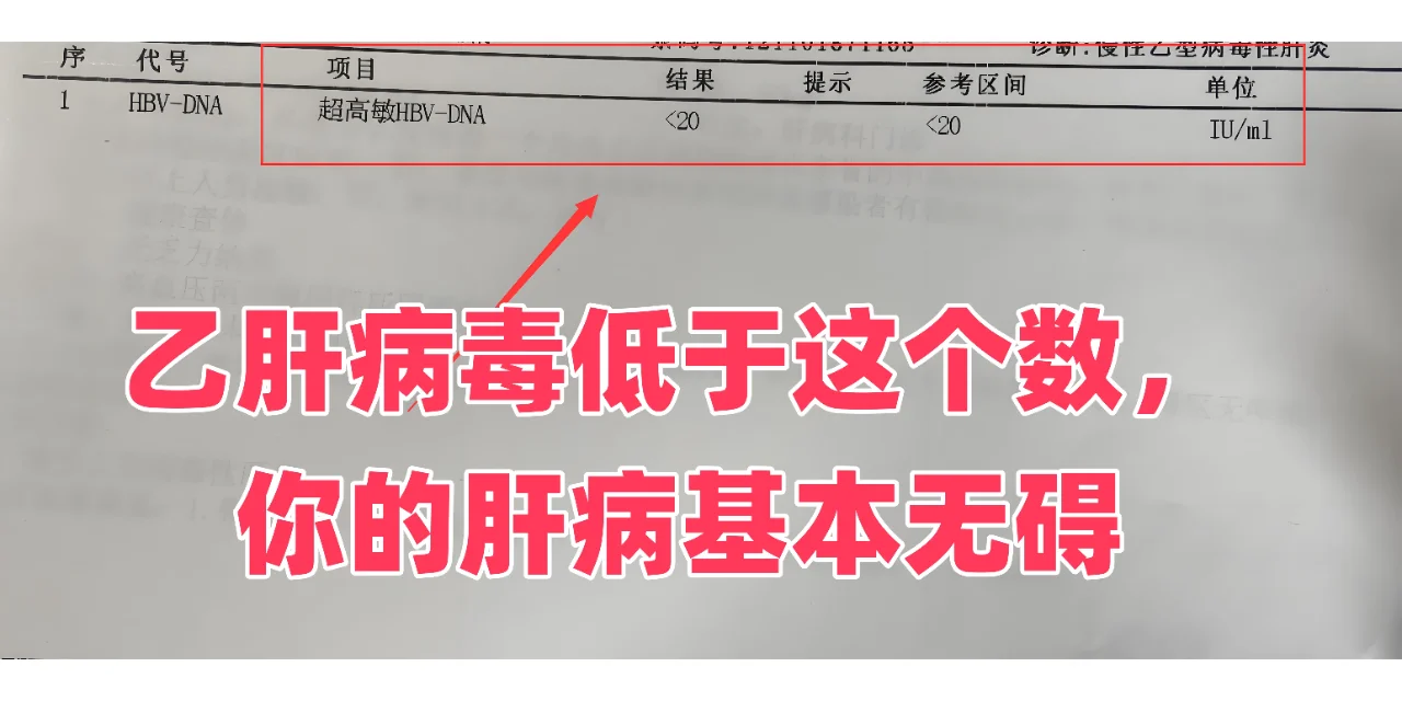 接诊山东潍坊的乙肝患者，近期因肝区疼痛到医院就诊，彩超显示回声弥漫性增...