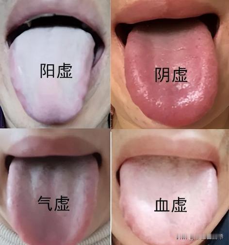 人体四大虚，教你一分钟自测

气虚人乏力
表现：萎靡不振、提不起劲，总想躺着、靠