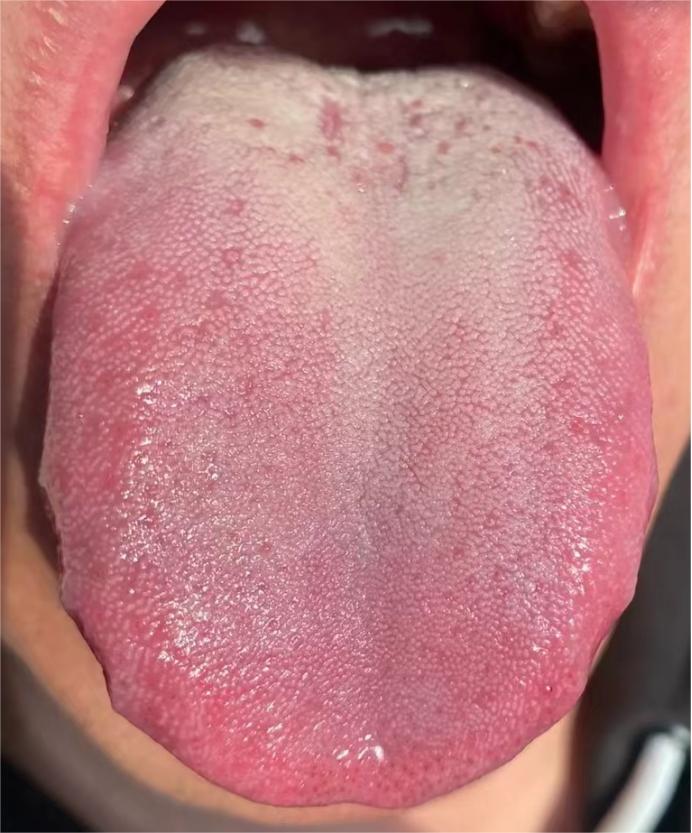 凡是这种舌象的人，都有个典型的特点，就是“欲望强”“想法多”“但很差劲”
 
这