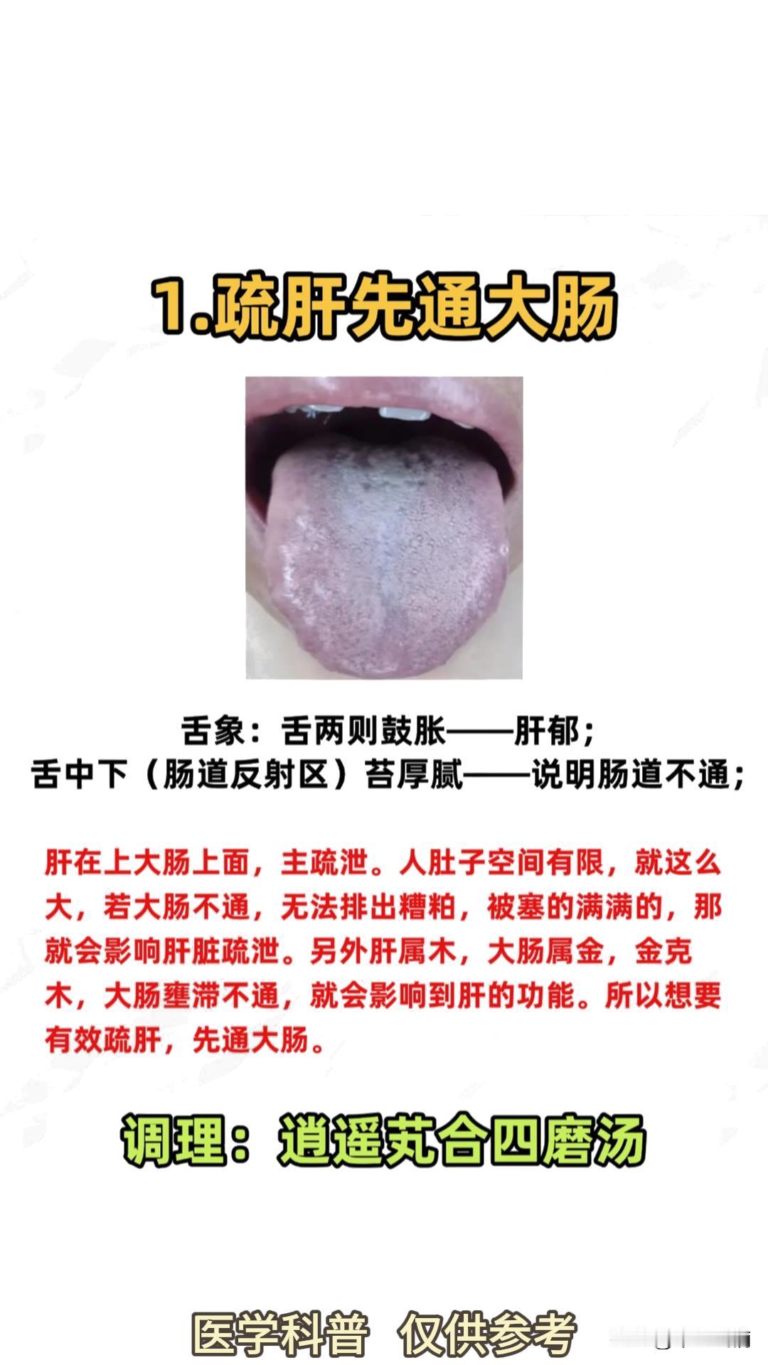 三种常见的舌象，你是哪一种呢