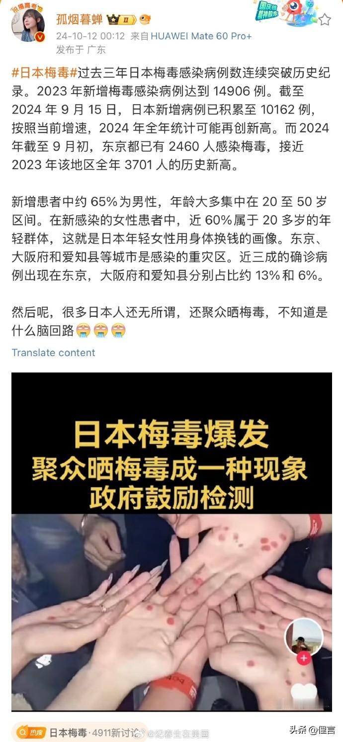 有人故意带节奏。#日本人聚众晒梅毒#是虚假的消息报道，与实际情况不符。那些碍国大